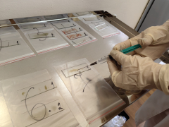 Вызывает ли биопсия рак?